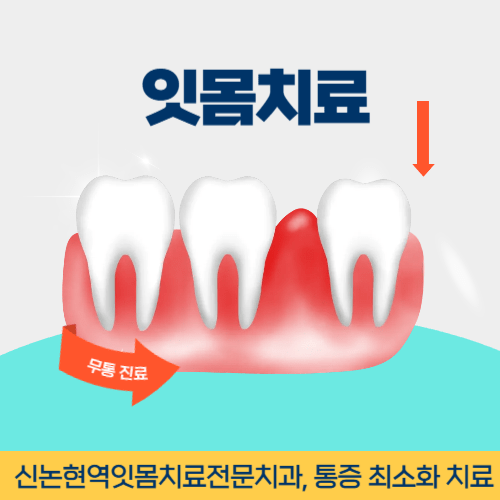 부산치과 부산광역시 치과 잇몸치료